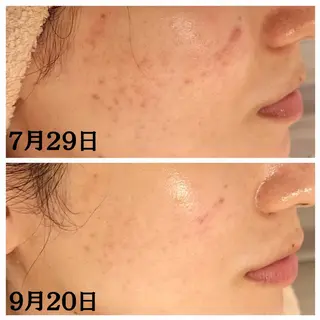 フェイシャル専門サロ ン ERINのエステ・リラクイメージ