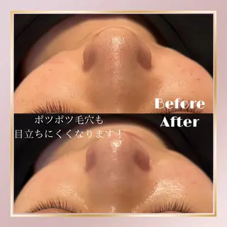 💎美容革命ラボ💎 大名店のエステ・リラクイメージ