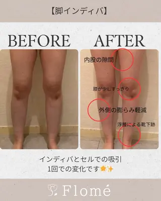 Flomé所属・山脇 はるかのエステ・リラクイメージ