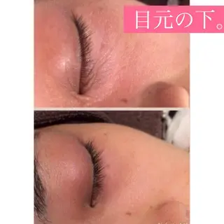 セミロング カラー パーマ ヘアアレンジ メンズ キッズ ネイル マツエク・マツパ 四つ星サロン🎖 腸＆ニキビケアに特化のエステ・リラクイメージ