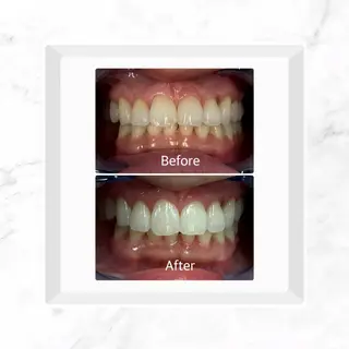 ホワイトニングサロンLUMIÉRE所属・ホワイトニングサロン LUMIÉREのその他イメージ