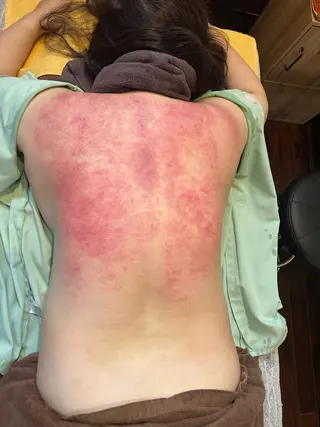 鍼灸院楽々館所属・宇田 碧のエステ・リラクイメージ