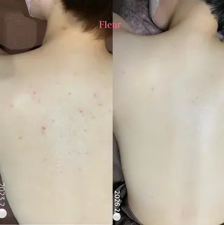 Fleur フルールのエステ・リラクイメージ