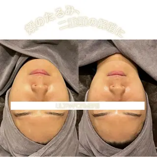 ☆痩身/小顔☆ 結果出します☆のエステ・リラクイメージ