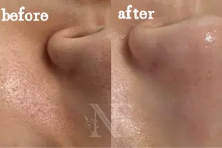 Nature Souce毛穴専門店のその他イメージ