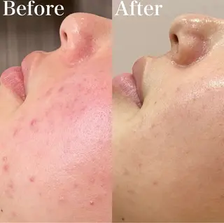 Amaryllis所属・あ あのエステ・リラクイメージ