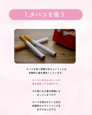 セルフホワイトニング エクシア大曽根店のその他イメージ