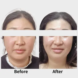 看護師 AYUIのエステ・リラクイメージ