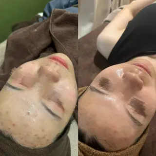 # fu♡のエステ・リラクイメージ