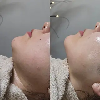 夜限定SARON YISMのエステ・リラクイメージ