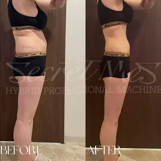 B-st. 下北沢のエステ・リラクイメージ