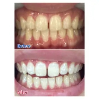 MBEAUTYSALON 千葉店・京成大久保所属・Melty 輝のその他イメージ