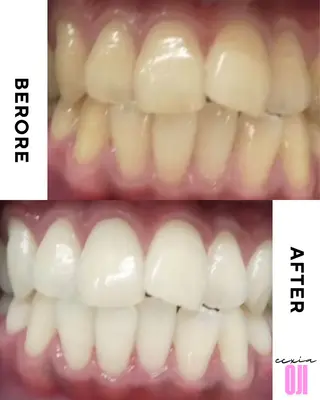 セルフホワイトニングサロン  エクシアホワイト 王寺店所属・エクシア王寺 NISHIKAWAのその他イメージ