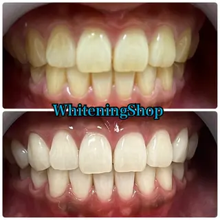 ホワイトニング ショップ吉祥寺店のエステ・リラクイメージ