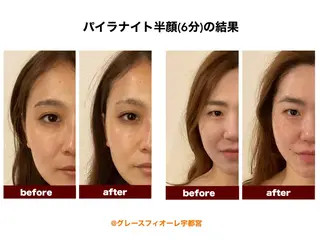 【Agrea】 RISAのエステ・リラクイメージ