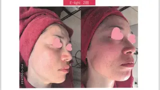 private salon meのエステ・リラクイメージ