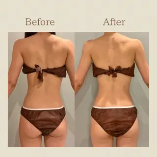 お腹痩せエステ Flat BELLY 恵比寿所属・【腸もみ/冷却痩身】 お腹エステ/恵比寿のエステ・リラクイメージ