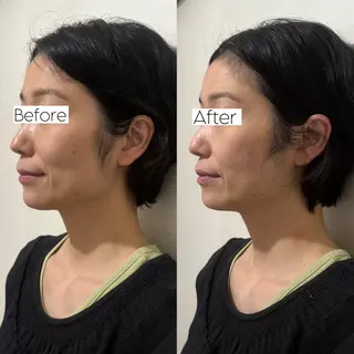 Private salon La.所属・Stellum 小顔矯正&ヘッドスパのエステ・リラクイメージ