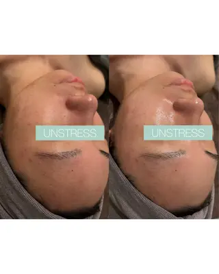 ☆痩身/小顔☆ 結果出します☆のエステ・リラクイメージ