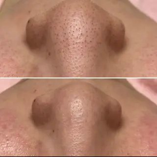 EARTH coiffure beaute 新潟紫竹山店所属・🤍アベシュリ /フェイシャル🤍のエステ・リラクイメージ