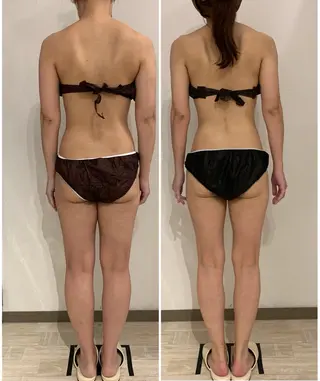 リンパマッサージ&ピラティスmimoza所属・リンパマッサージ mimozaのエステ・リラクイメージ