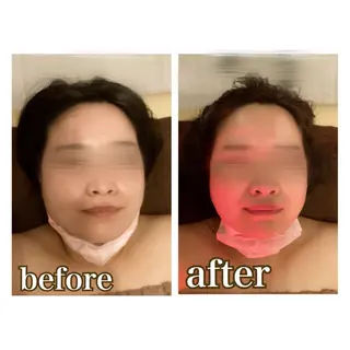 美腸専門 漢方よもぎ蒸しのエステ・リラクイメージ