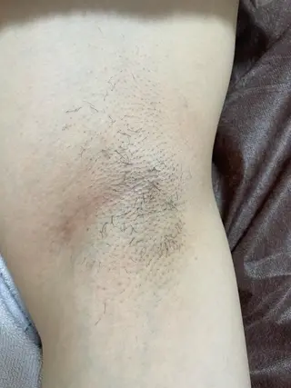 メンズ キッズ 脱毛SALON RaYNiCKのエステ・リラクイメージ