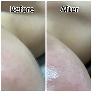 林 陽向のエステ・リラクイメージ