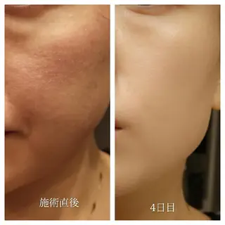 🅖🅤🅩🅔🅛 salonのエステ・リラクイメージ