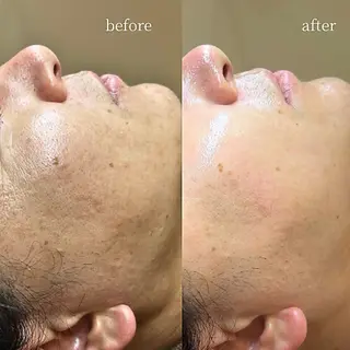 韓国肌管理・肌質改善 EARNEST心斎橋のエステ・リラクイメージ