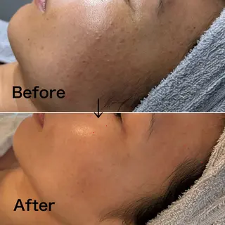 Blue Moon 【ブルームーン】のエステ・リラクイメージ