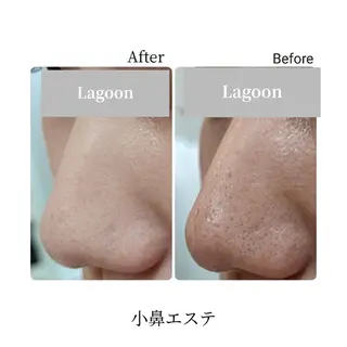 脇山 千佳のエステ・リラクイメージ