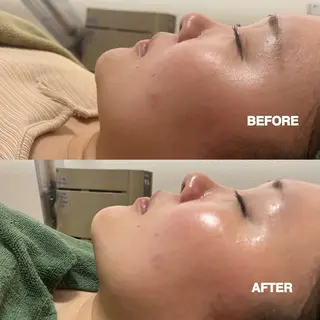 お顔そりルーム小春空所属・＊ HARUKAのその他イメージ