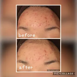 美肌蘇生カウンセラー 横山りえのエステ・リラクイメージ