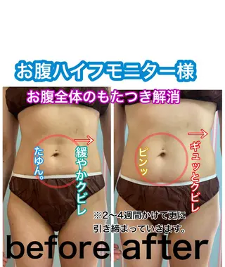 痩身/脱毛/ネイル HARUKAのエステ・リラクイメージ