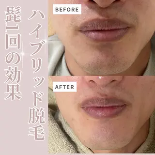 プライベートサロン Belle(ベル)のエステ・リラクイメージ