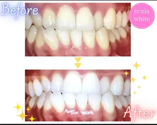 エクシアホワイト旭橋店所属・セルフホワイトニング エクシア旭橋店のその他イメージ