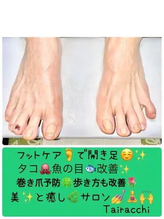 ネイル Tairacchi ﾀｲﾗｯﾁのエステ・リラクイメージ