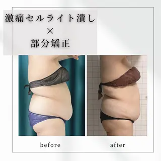 小顔矯正専門店 【RED】池田のエステ・リラクイメージ