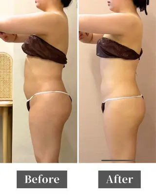 姿勢矯正専門店Asmy天王寺店所属・Asmy 天王寺のエステ・リラクイメージ