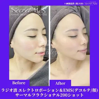 メンズ 有人型セルフサロン 脱毛/痩身/美顔のその他イメージ