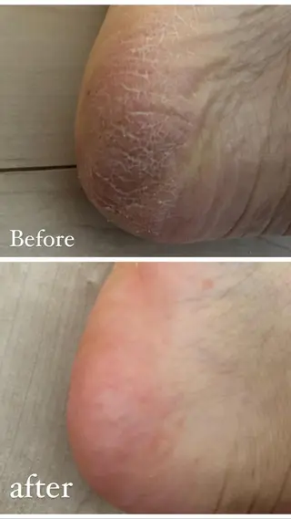 ❤︎MN❤︎ モンのエステ・リラクイメージ