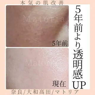 小顔と美肌 まごころエステMatoria所属・小顔 美肌専門 Matoriaのエステ・リラクイメージ