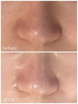 毛穴シミ改善専門 サロンド・ルパークのエステ・リラクイメージ