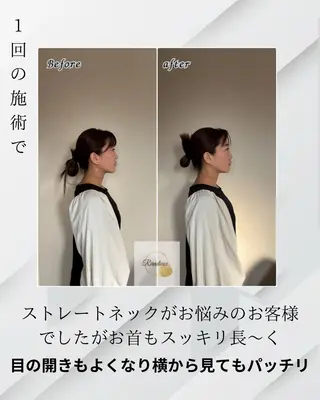 Riradieux ﾘﾗﾃﾞｭ所属・Riradieux 美骨小顔矯正のその他イメージ