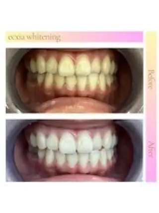 セルフホワイトニング エクシア西宮北口店所属・セルフホワイトニング エクシア西宮北口店のその他イメージ