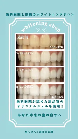 ホワイトニングショップ伊丹店所属・ホワイトニング ショップ伊丹店のその他イメージ