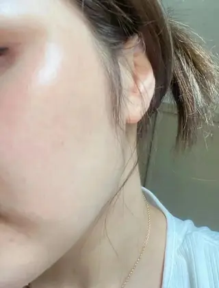 aliaハイフ&水光ジェットサロン所属・aliaハーブ水光店 エステティシャン募集のエステ・リラクイメージ