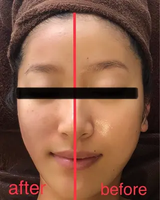 M'int所属・M'int 福原のエステ・リラクイメージ