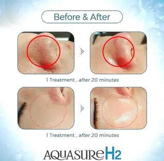 Lila プライベートサロンのエステ・リラクイメージ